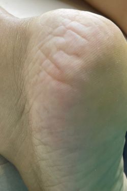 Beauté des pieds avant - L'Atelier by Anne-Sophie