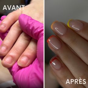 Ongles rongés - L'Atelier by anne-Sophie - Institut de beauté à Bondy